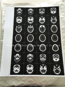 White Medical X-ray Film for Ect CT Cr MRI